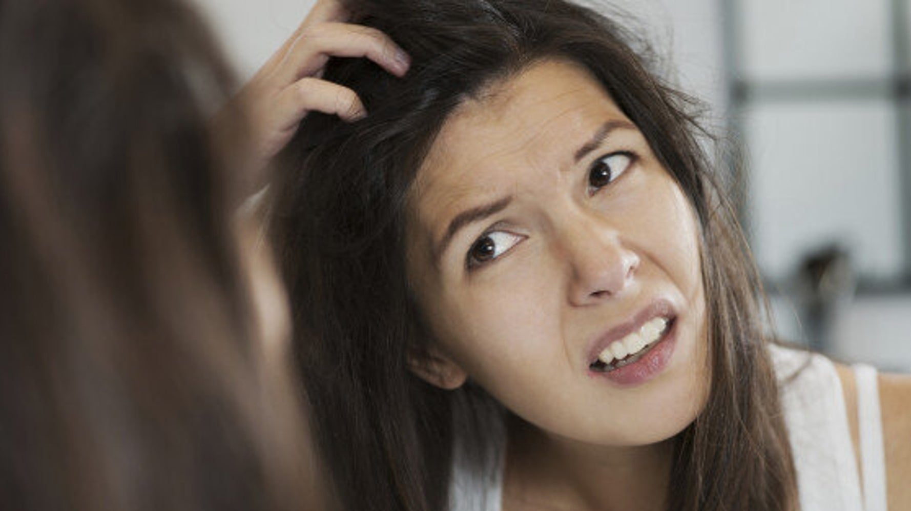 The Real Cause Of Dandruff Is Not What You Think HuffPost Canada Life