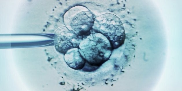 Embryo selection for IVF, light micrograph.