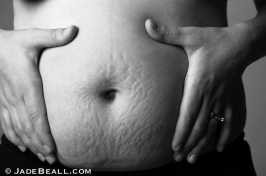 15 of the most beautiful self-portraits of stretch marks 2 Chrissy Teigen Jokes About Her Mom Stretch Marks On Snapchat | HuffPost Parents