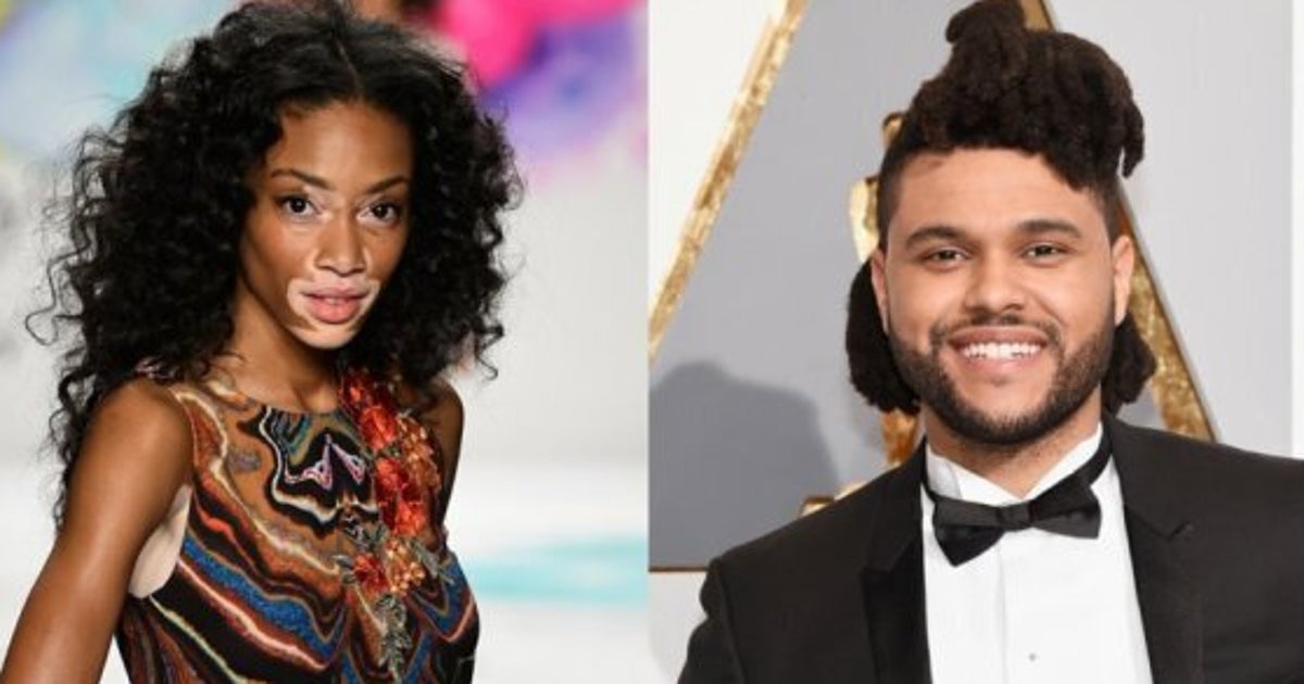 Canadians Winnie Harlow, The Weeknd Shine In Beyoncé's New Album