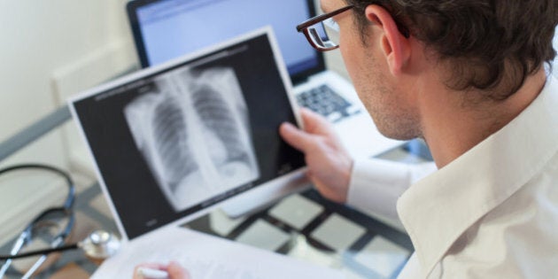 doctor checking at x-ray of lungs and writing diagnosis, clinic