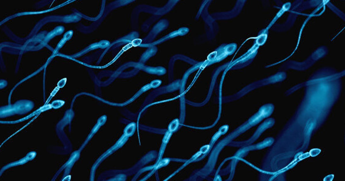 This Is How Sperm Perfect Their Swimming Technique HuffPost Parents