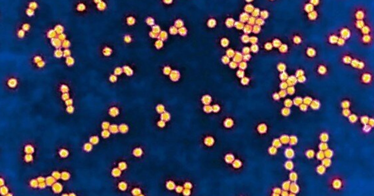 Avoid Food Poisoning Identifying Spoiled Onions By Their White Juice - gsz5ge5