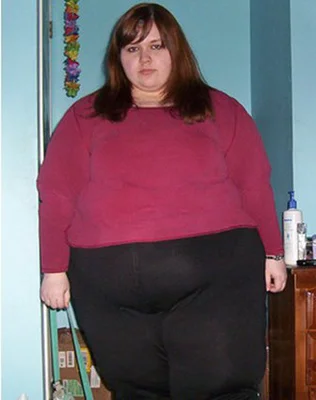 Weight Lost Terrified She Wouldn T Be Able To Move This Woman Lost 179 Pounds Huffpost Canada Life