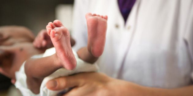 Doctor or nurse is holding a baby. Baby's feet are most in focus. Baby is malnourished and tiny. Baby is wearing a diaper.