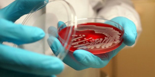 Microbiologist examining growth of MRSA bacteria on a culture plate, Microbiology, MRSA, superbugs, laboratory, gloves, scientist.