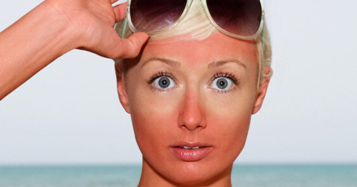 summer-makeup-tips-how-to-cover-up-a-sunburn-huffpost-style