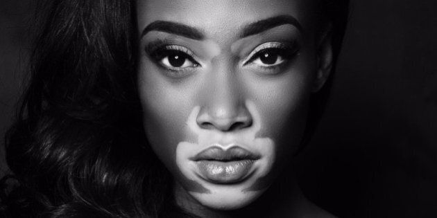 Winnie Harlow Doesnt Want You To Call Her A Role Model Huffpost Life