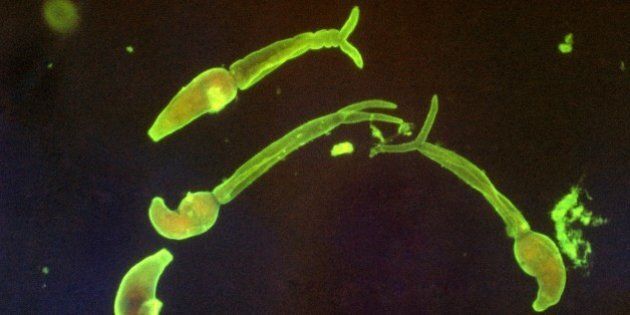 Cercariae of Schistosoma mansoni. Indirect fluorescent antibody (IFA) stain. Parasite. Image courtesy CDC/Dr. Sulzer, 1963. (Photo by Smith Collection/Gado/Getty Images).