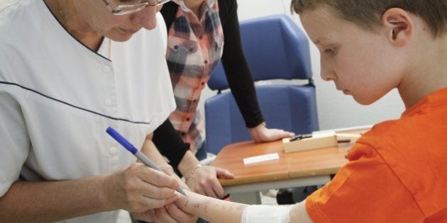 Allergology department of Saint-Vincent de Paul hospital, GHICL, Lille. Food Allergies, Prick test using reference allergens, on a boy's skin. (Photo By BSIP/UIG via Getty Images)