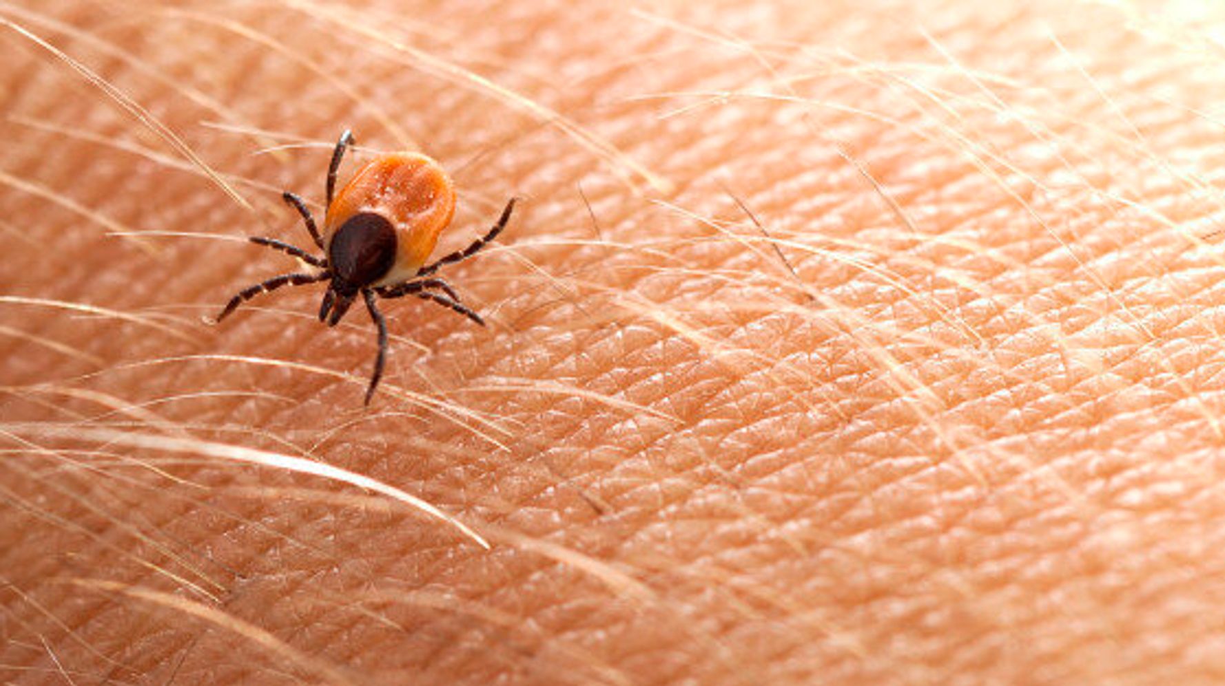 This Summer Protect Yourself From Tick Bites And Lyme Disease