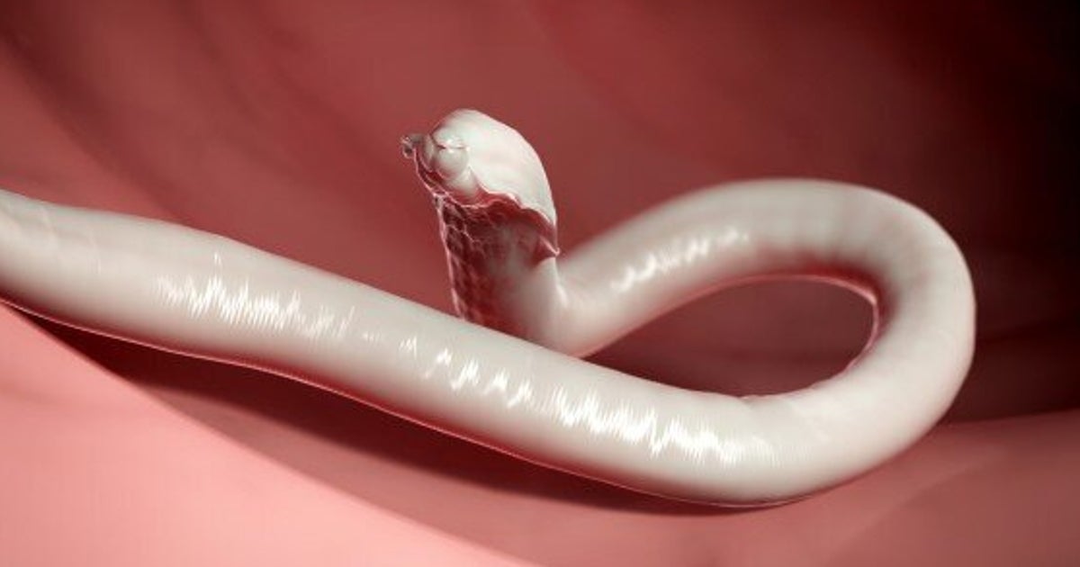 parasitic-worm-might-increase-women-s-fertility-huffpost-life