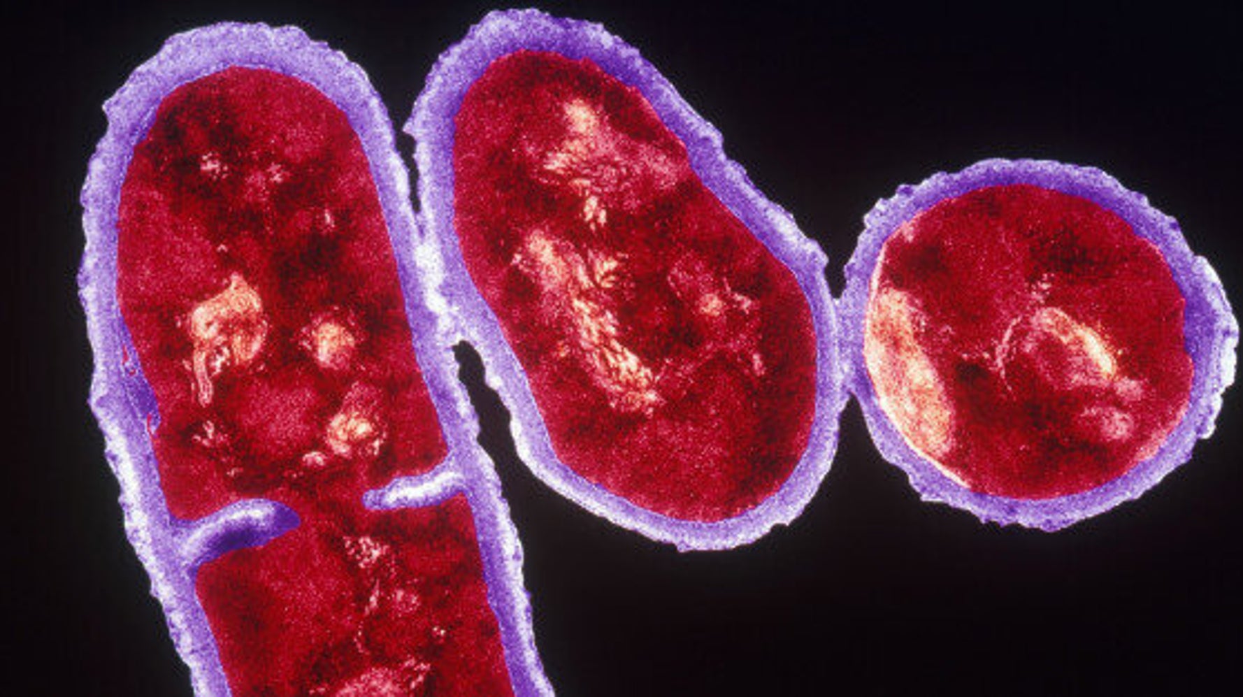 prostatitis akne