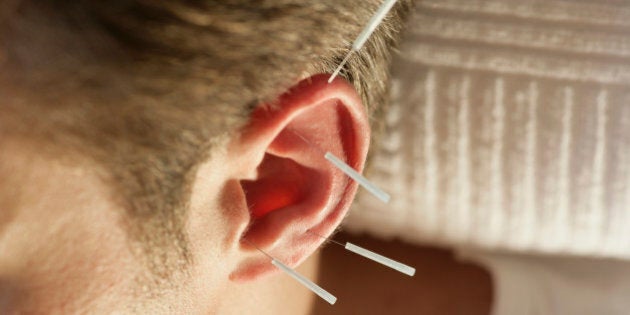 Buy earlobe support patches Online in South Africa at Low Prices at  desertcart