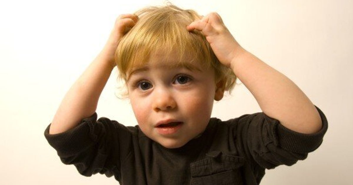 Hair Lice Treatment New 'super Lice' Are Resistant To Overthecounter