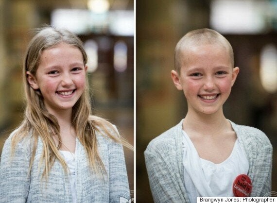 Calgarys Sofia Smith Captures Hearts Worldwide After Shaving Head For 