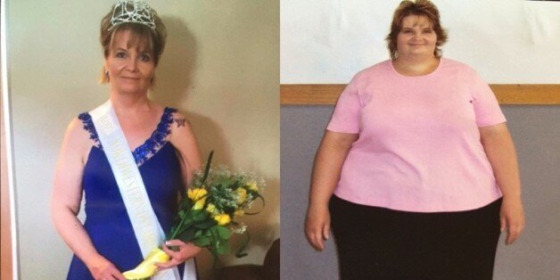LongTerm Weight Loss It Took 10 Years Of Focus For This Woman To Lose