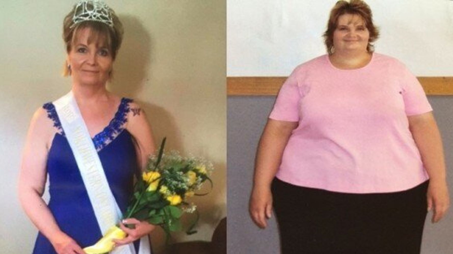 Long Term Weight Loss It Took 10 Years Of Focus For This Woman To Lose 190 Pounds Huffpost 