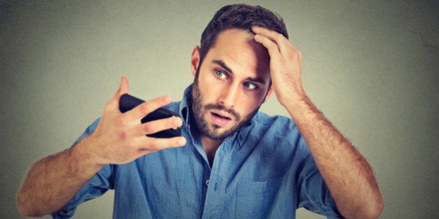 Closeup portrait, shocked man feeling head, surprised he is losing hair, receding hairline, bad news isolated on gray wall background. Negative facial expressions, emotion feeling