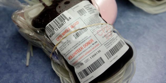 This Aug. 20, 2013, photo shows blood donated at the Indiana Blood Center Bloodmobile in Indianapolis. The demand for blood is dwindling due to fewer elective surgeries and medical advances that curb bleeding in the operating room. The Indiana Blood Center announced in June 2013 that it would eliminate 45 positions because demand from hospitals had fallen 24 percent from the previous year. (AP Photo/Michael Conroy)