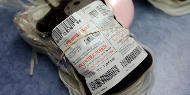 This Aug. 20, 2013, photo shows blood donated at the Indiana Blood Center Bloodmobile in Indianapolis. The demand for blood is dwindling due to fewer elective surgeries and medical advances that curb bleeding in the operating room. The Indiana Blood Center announced in June 2013 that it would eliminate 45 positions because demand from hospitals had fallen 24 percent from the previous year. (AP Photo/Michael Conroy)