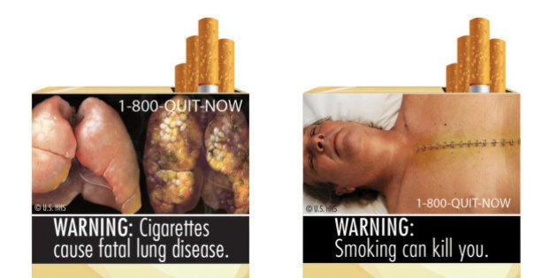 FILE - This combination photo made from file images provided by the U.S. Food and Drug Administration shows two of nine cigarette warning labels from the FDA. A judge on Wednesday, Feb. 29, 2012 blocked the federal requirement that would have begun forcing U.S. tobacco companies to put large graphic images on their cigarette packages later this year to show the dangers of smoking and encouraging smokers to quit lighting up. (AP Photo/U.S. Food and Drug Administration, File)