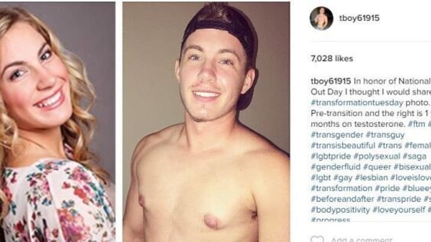 trans-man-s-before-and-after-photos-prove-there-s-no-one-way-to-look