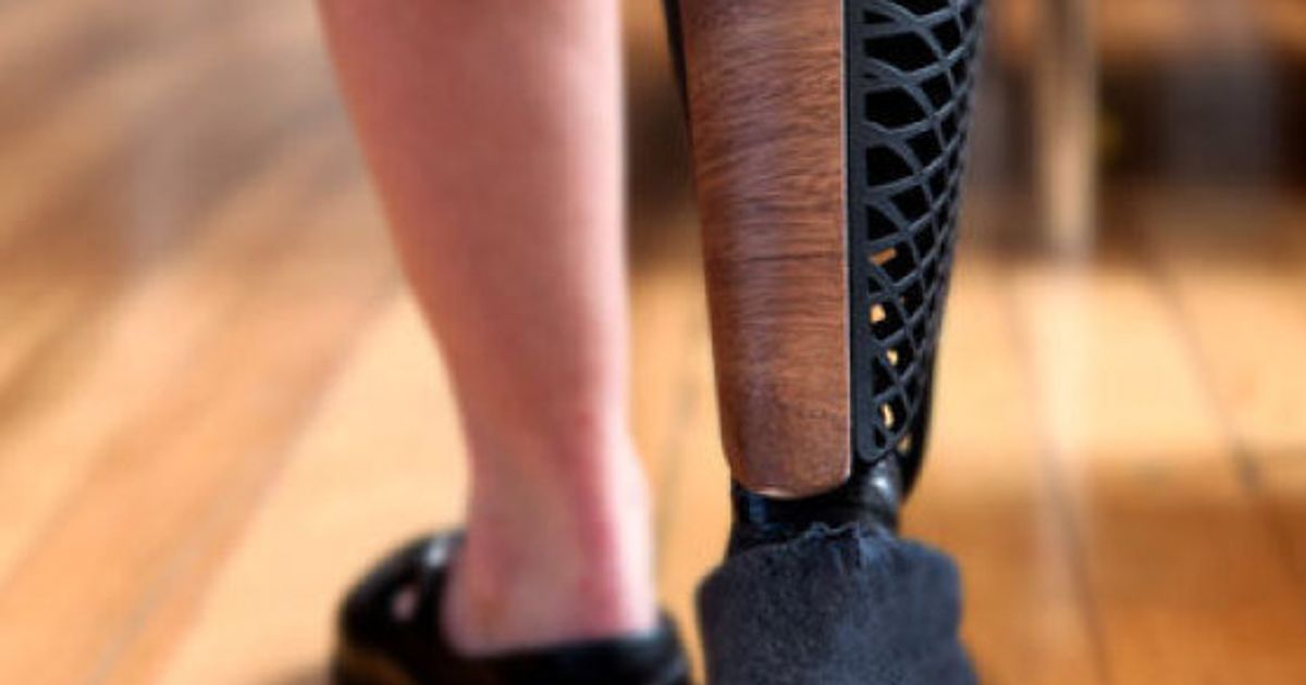 Stylish Prosthetic Limbs Boost Amputees' Quality of Life