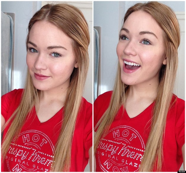 Benefits Of Raw Honey On Skin Reddit User Posts Remarkable Acne Transformation Photos Huffpost Canada benefits of raw honey on skin reddit