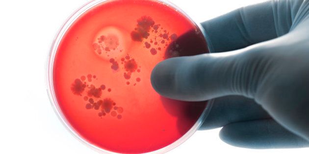 Holding bacteria plate