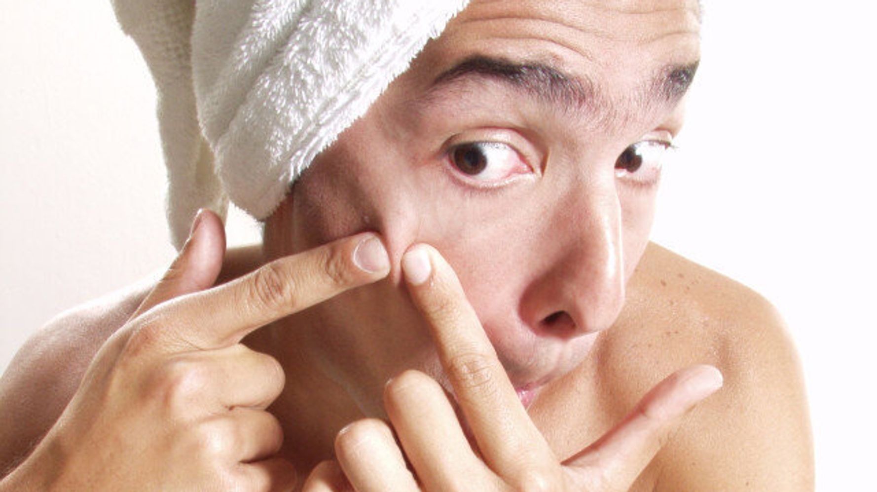 Pimple Popping Acne Blisters And Scabs 9 Things You Shouldnt Pop Huffpost Life