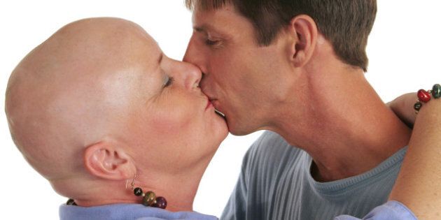 A loving couple kissing - the wife is undergoing chemotherapy treatment.