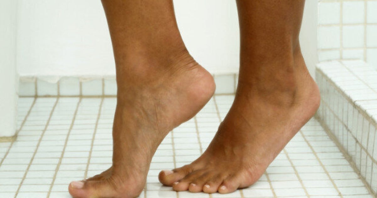 Athlete's Foot Natural Remedies To Treat Foot Fungus HuffPost Life