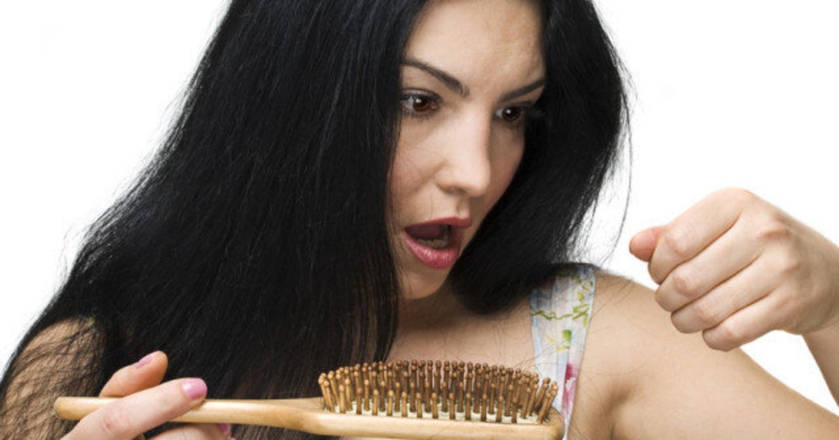 Women Hair Loss Unusual Reasons You Re Going Bald Photos