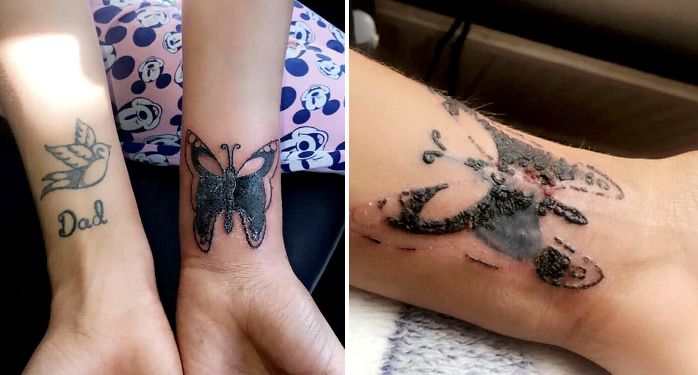 My tattoo got infected because my artist rushed through my tattoo &  essentially shredded off the top layer of skin.. been in the hospital a  week now with this. : r/shittytattoos