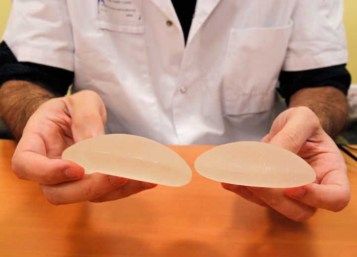 A plastic surgeon at the St Louis Hospital in Paris holds textured silicone gel breast implants that he removed from a patient because of concerns that they are unsafe.