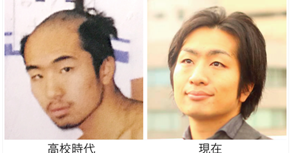 「#この髪でも大人やれてますバトン」 頭髪指導で悩んでいる子どもたちへ大人からのメッセージ
