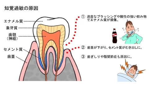 その痛みに寄り添いた!象牙質知覚過敏症 書籍詳細「その痛みに寄り添いたい！象牙質知覚過敏症