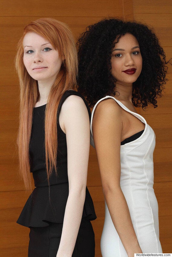 Twins Born With Different Skin Colours Everybody Asks If They Are