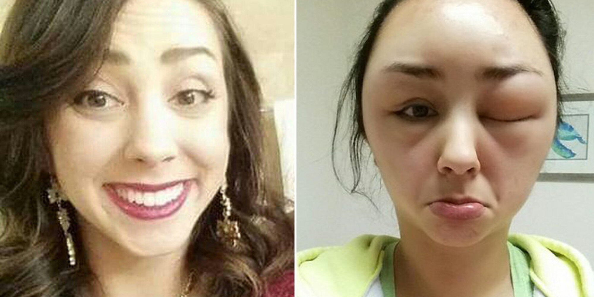Woman couldnt open her eyes as hair dye reaction felt like ants biting  her  World News  Mirror Online
