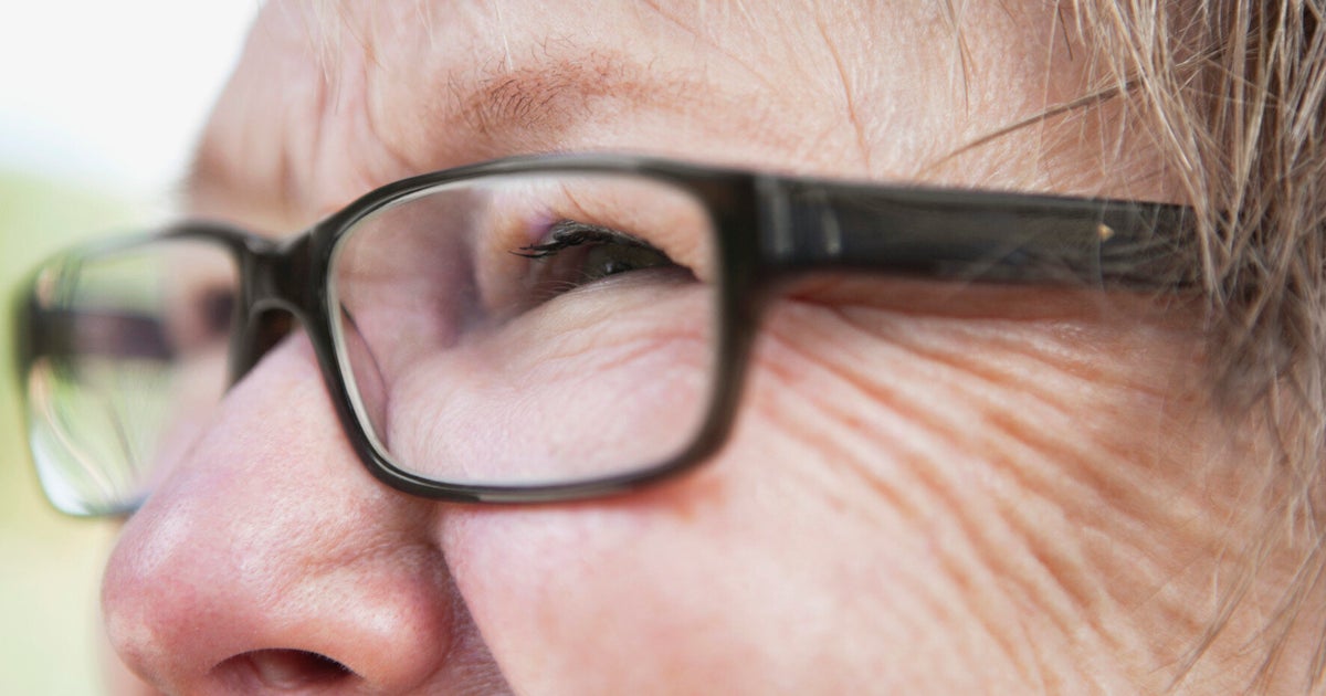 Cholesterol Drug Could Restore Vision In Patients With AgeRelated