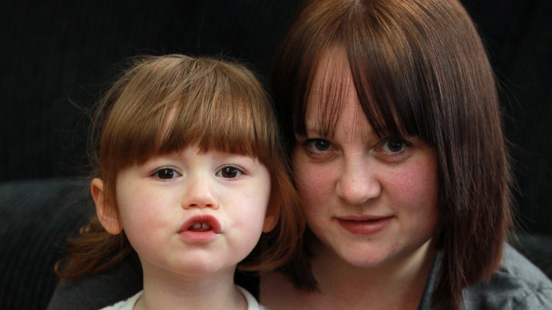 Baby swallowed battery acid Idea hostalelportalico