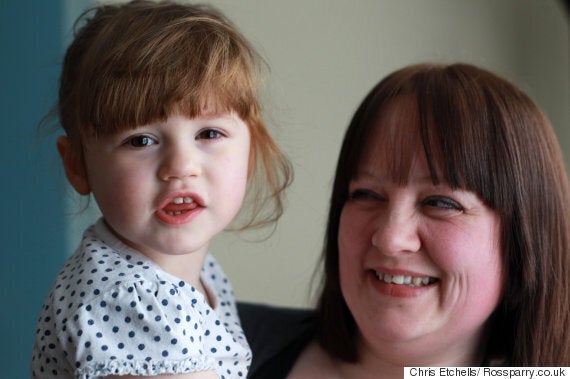 Toddler Swallowed Lithium Battery Which 'Burned Through Lung' And Spent ...