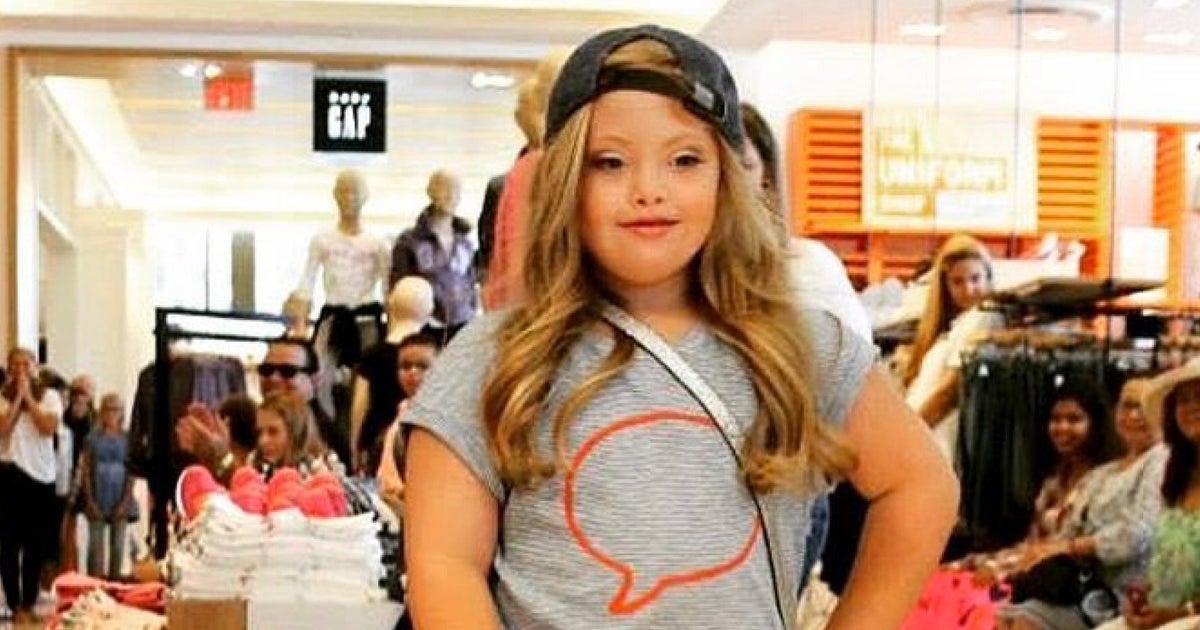 Kayla Kosmalski, Model With Down's Syndrome, Walks Catwalk For Gap Kids