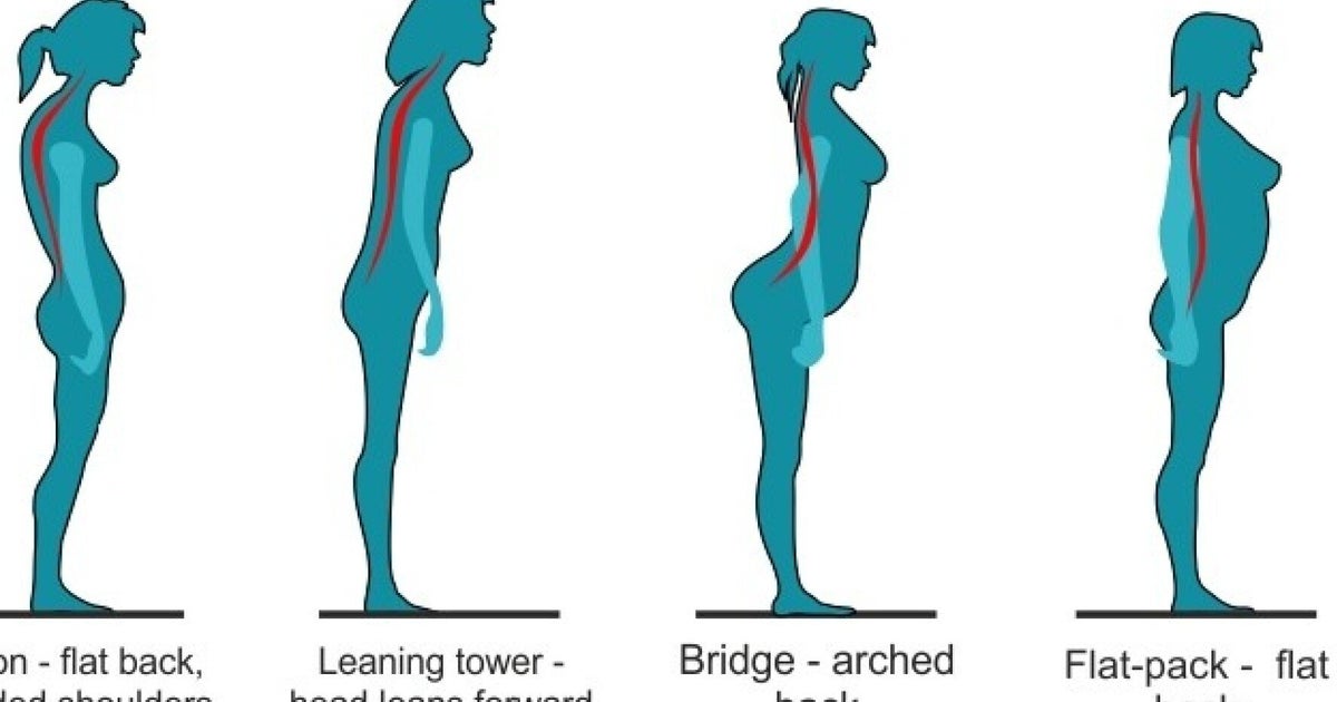 could-poor-posture-be-causing-your-back-pain-this-graphic-reveals-if