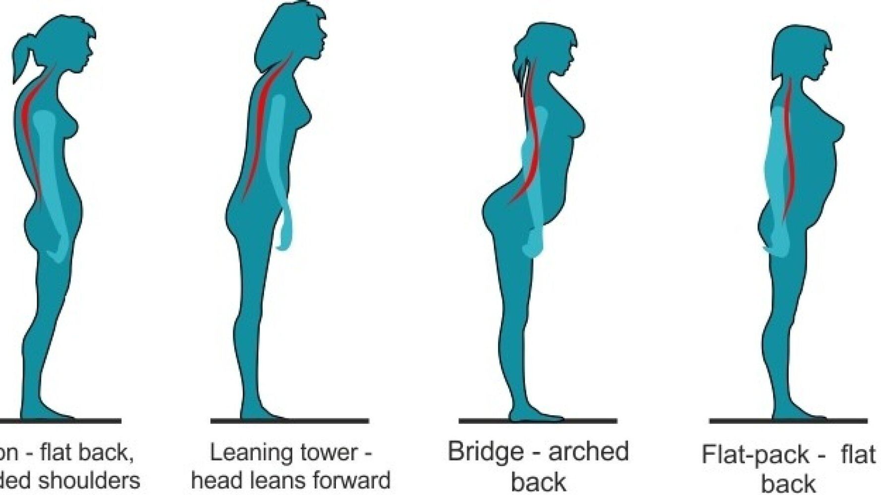 Graphic Reveals The Worst Posture For Back Pain.