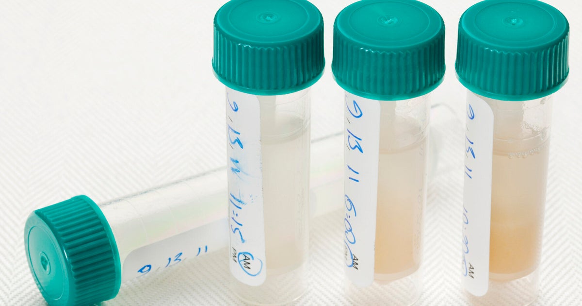 DIY Saliva Test That Detects Cancer Could Be Available In