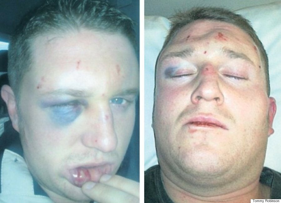 Tommy Robinson Explains The Making Of An Alter-Ego Even His Wife Can't