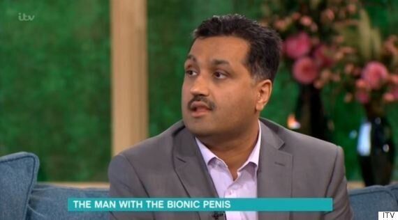 This Morning Man Without Penis Makes Return Appearance To Reveal His Bionic New Member