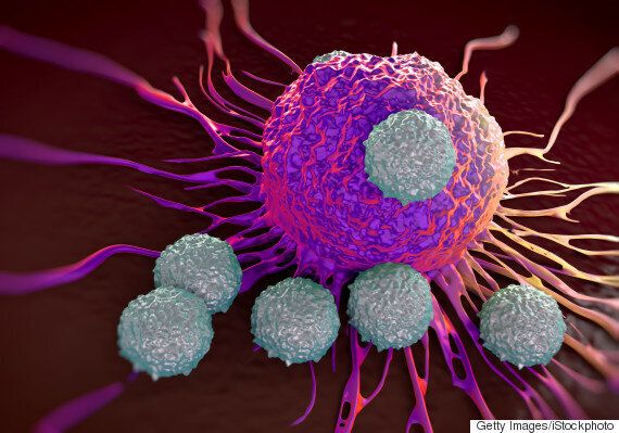 Cancer Breakthrough Scientists Find Achilles Heel Of Tumours